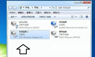 电脑系统有2个本地连接的解决方法